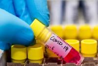 Количество зараженных коронавирусом во Львовской области выросло еще на 177