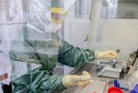У работника Днепропетровской ОГА обнаружили коронавирус, еще более 50 ожидают результаты тестов