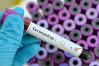 Власти США одобрили пятиминутный тест на коронавирус